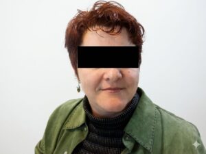 עור פנים של לקוחה בתאורה טבעית, ללא פגמים נראים לעין
