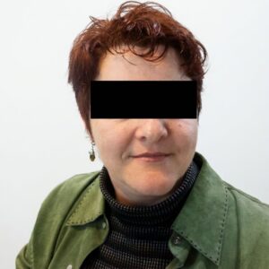 עור פנים של לקוחה בתאורה טבעית, ללא פגמים נראים לעין
